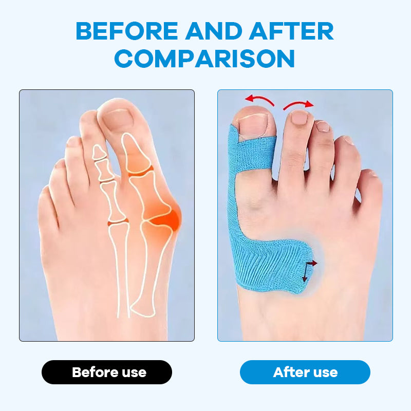 Usynlig Hallux Valgus Tape – Præskåret Korrektion til Skæv Storetå